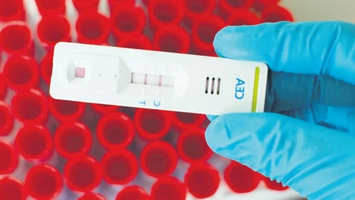 Kalınbağırsak kanserine karşı 2 yılda bir ücretsiz test